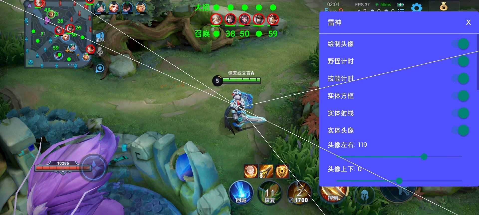 王者荣耀【XXS】辅助